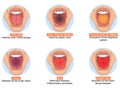 Illustration of diagnosis of different diseases